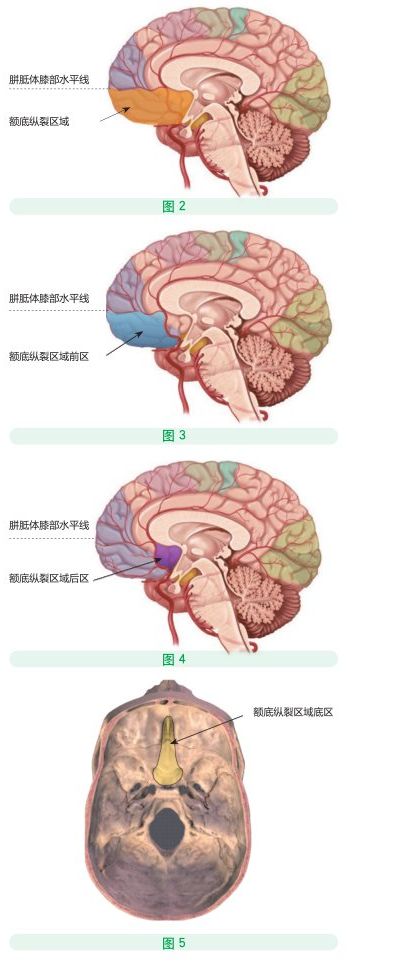 不仅耗时,而且若在分离过程中,对双侧额叶皮层及其表面静脉的损伤过重